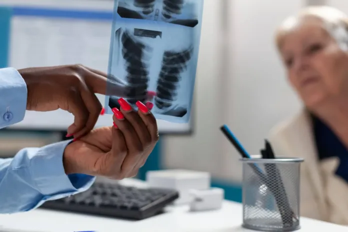 Can TB Return? Understanding TB Relapse and Reinfection