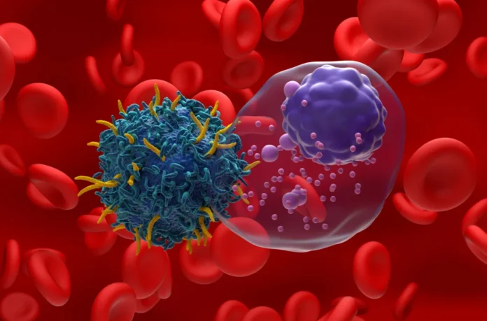 South Africa Shows a Higher Incidence of Multiple Myeloma Compared with Global Trends