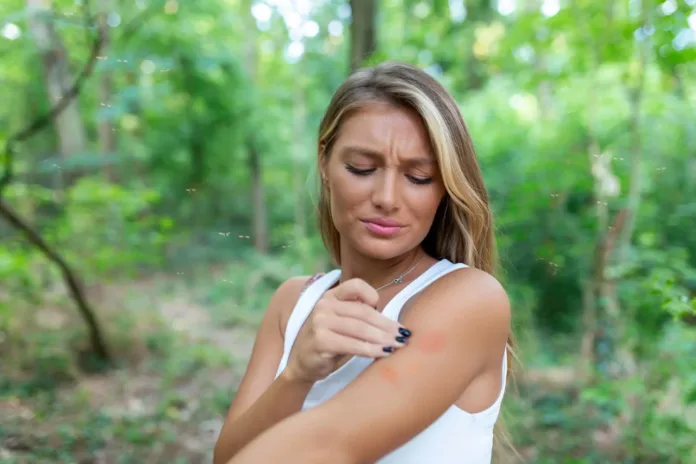When An Insect Bite Is More Serious Than You Think