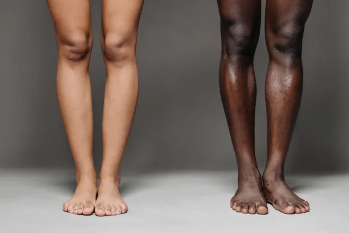 Before Barefoot Season Begins, Give Your Feet a Once-Over